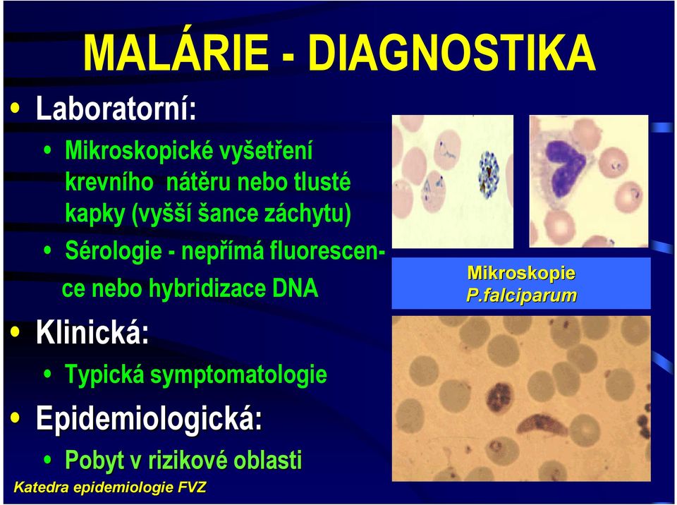 fluorescence nebo hybridizace DNA Klinická: Typická symptomatologie