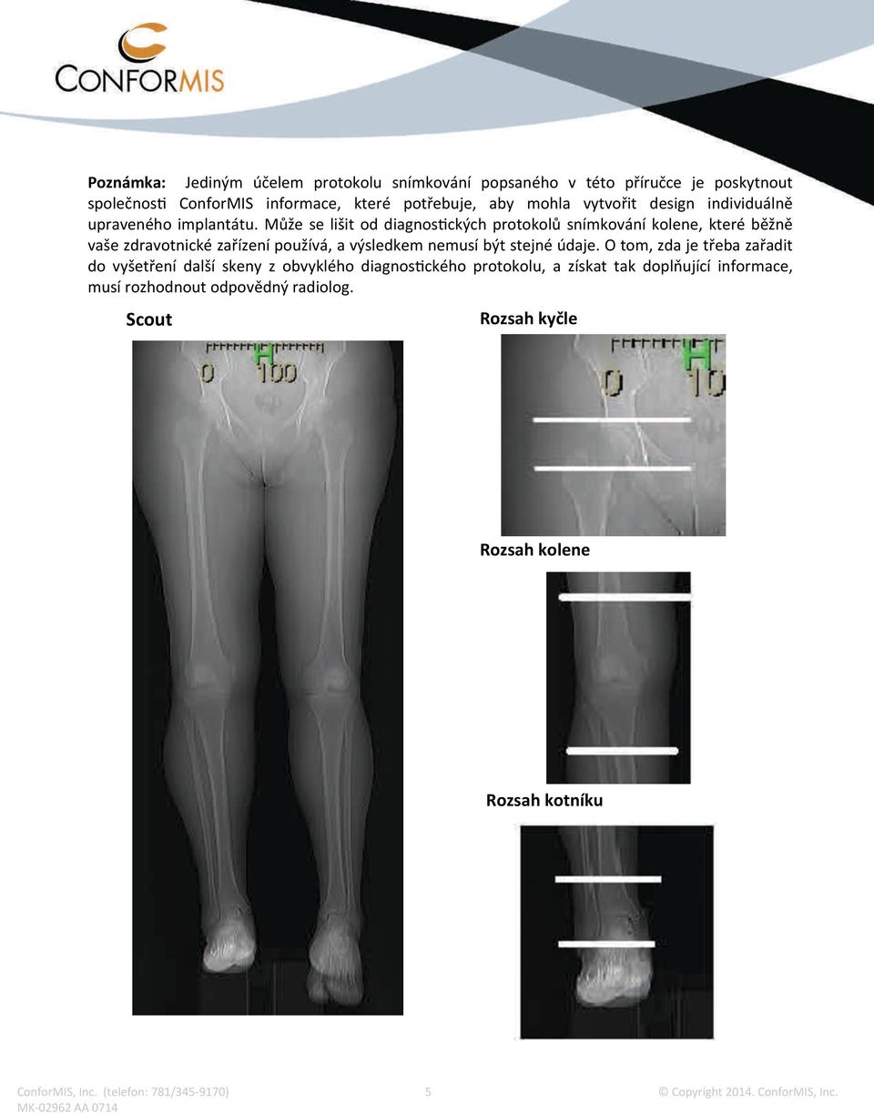 Může se lišit od diagnos ckých protokolů snímkování kolene, které běžně vaše zdravotnické zařízení používá, a výsledkem nemusí být stejné údaje.