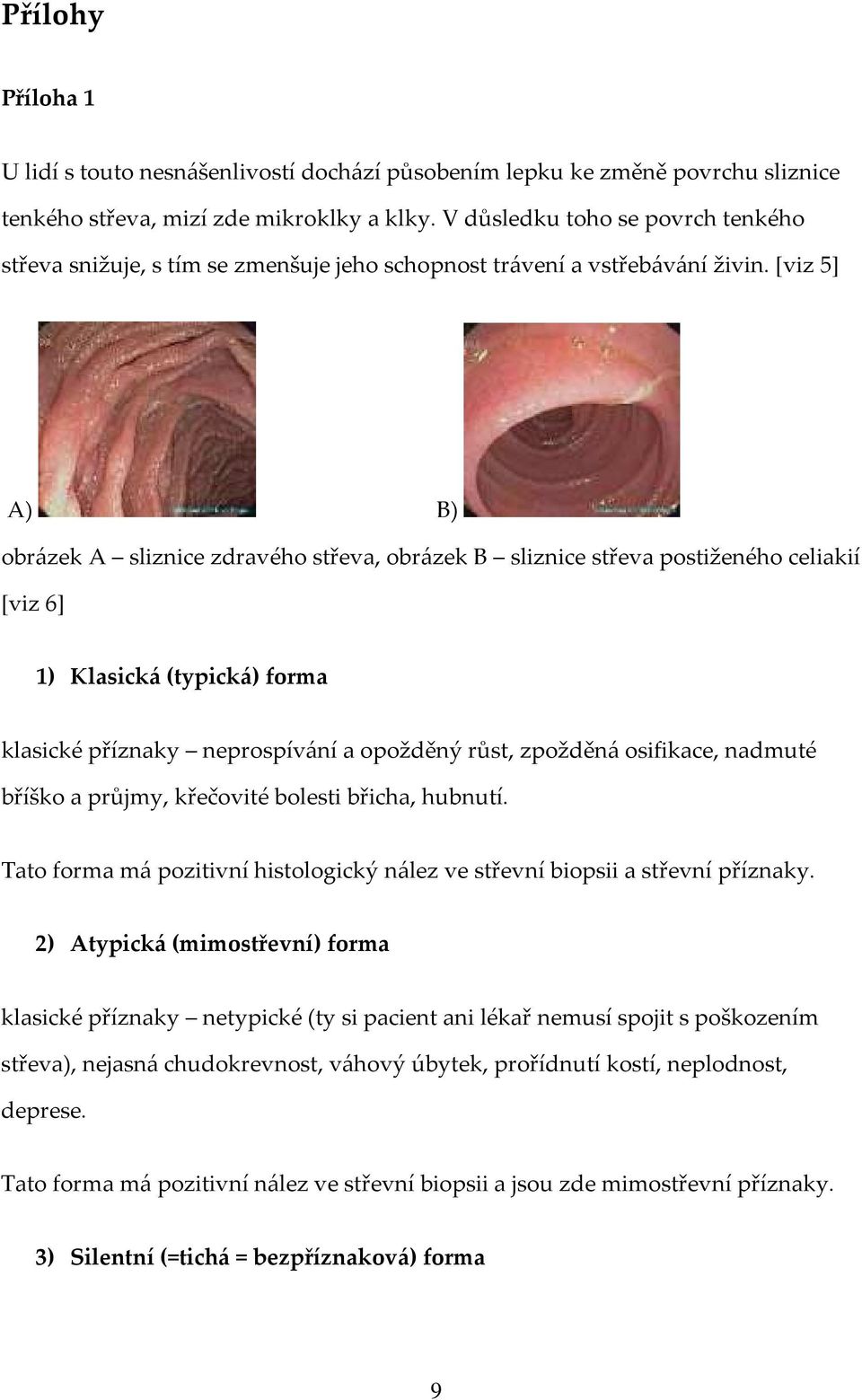 [viz 5] A) B) obrázek A sliznice zdravého střeva, obrázek B sliznice střeva postiženého celiakií [viz 6] 1) Klasická (typická) forma klasické příznaky neprospívání a opožděný růst, zpožděná