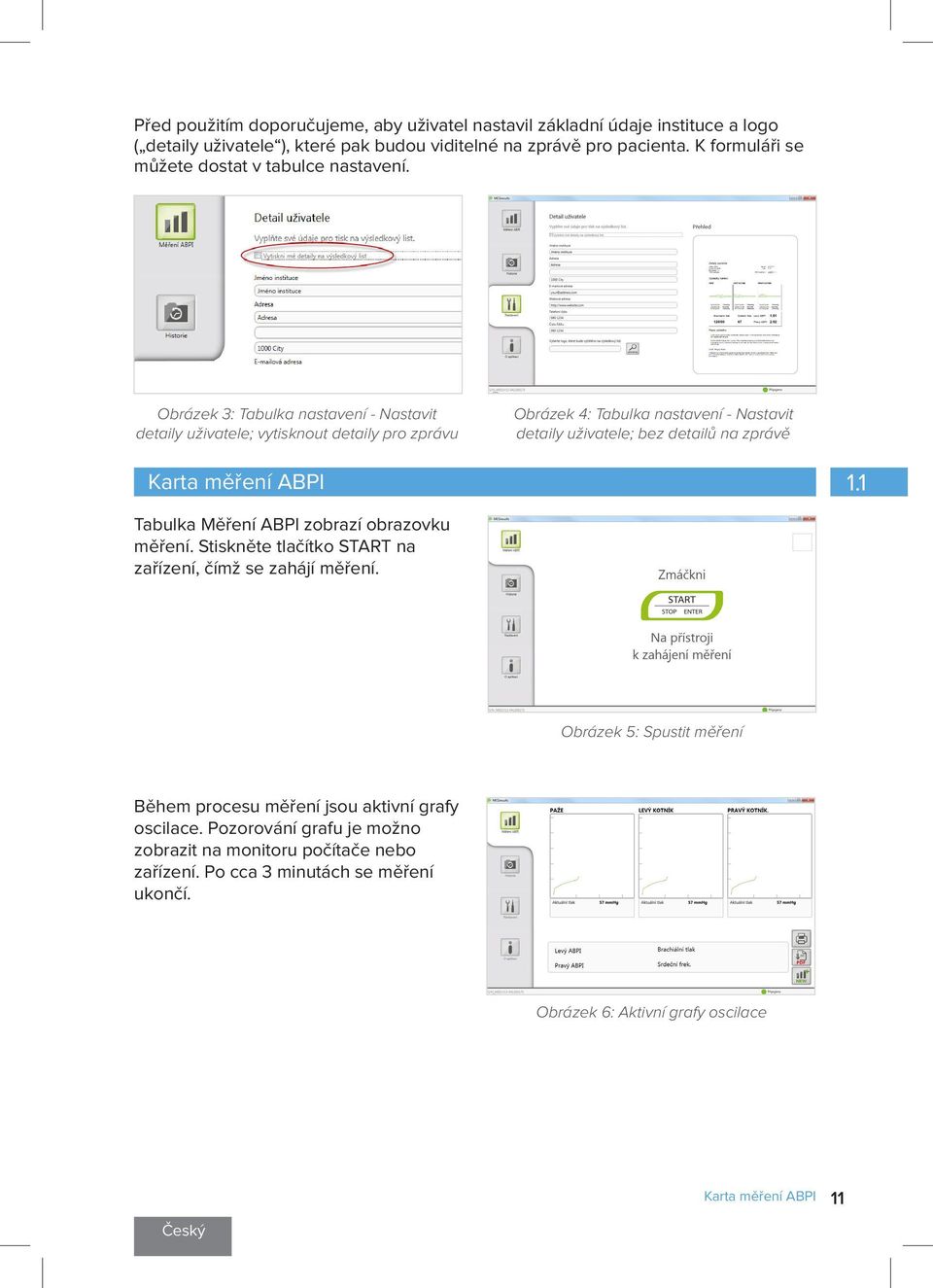 Obrázek 3: Tabulka nastavení - Nastavit detaily uživatele; vytisknout detaily pro zprávu Obrázek 4: Tabulka nastavení - Nastavit detaily uživatele; bez detailů na zprávě Karta měření