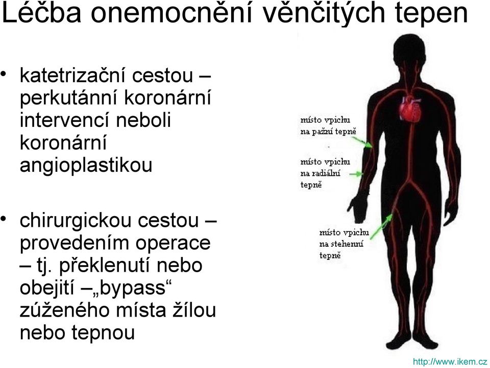 angioplastikou chirurgickou cestou provedením operace tj.