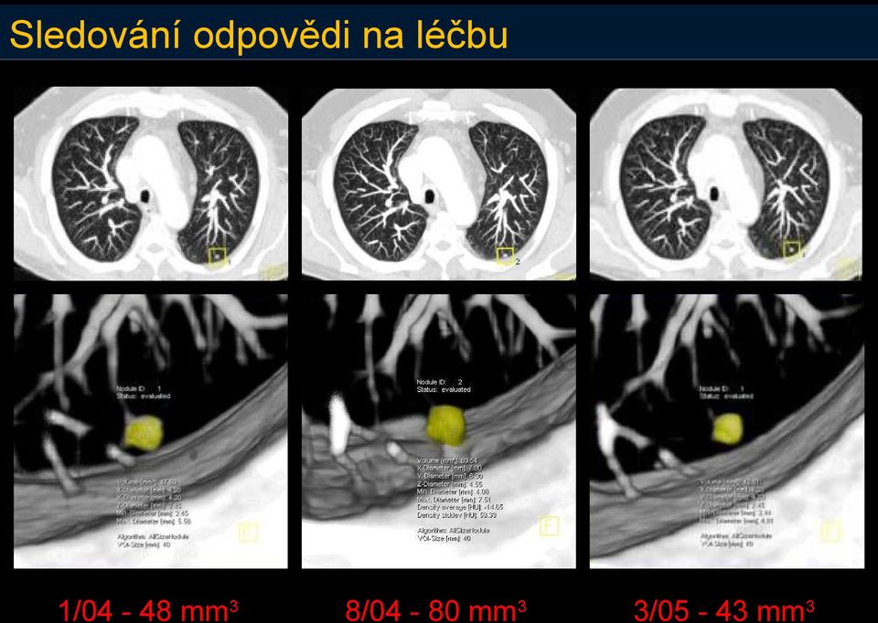 léčbu 1/04-48