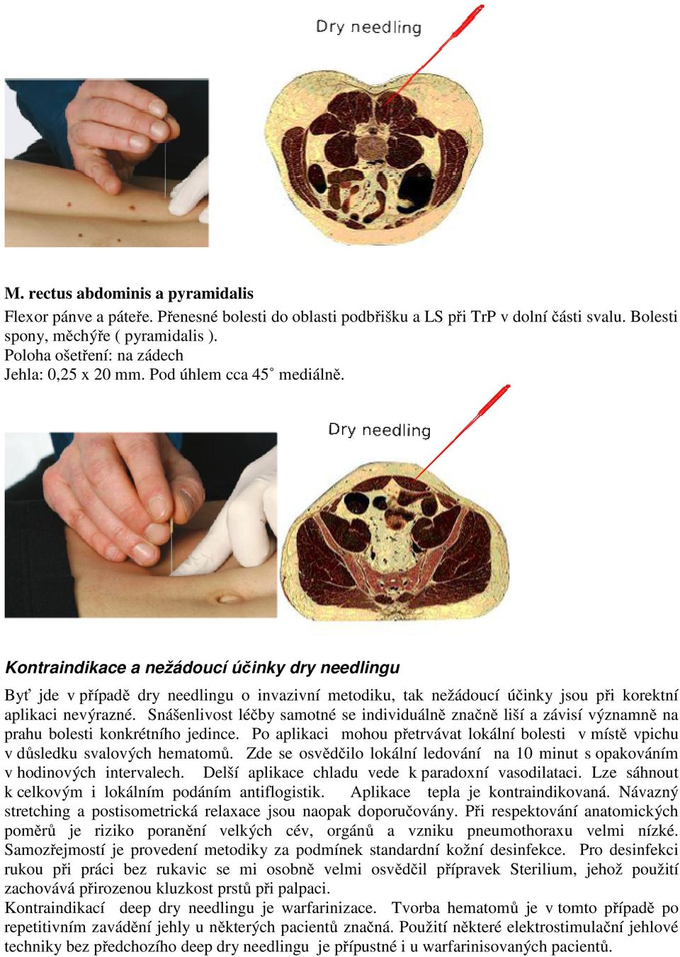 Kontraindikace a nežádoucí účinky dry needlingu Byť jde v případě dry needlingu o invazivní metodiku, tak nežádoucí účinky jsou při korektní aplikaci nevýrazné.