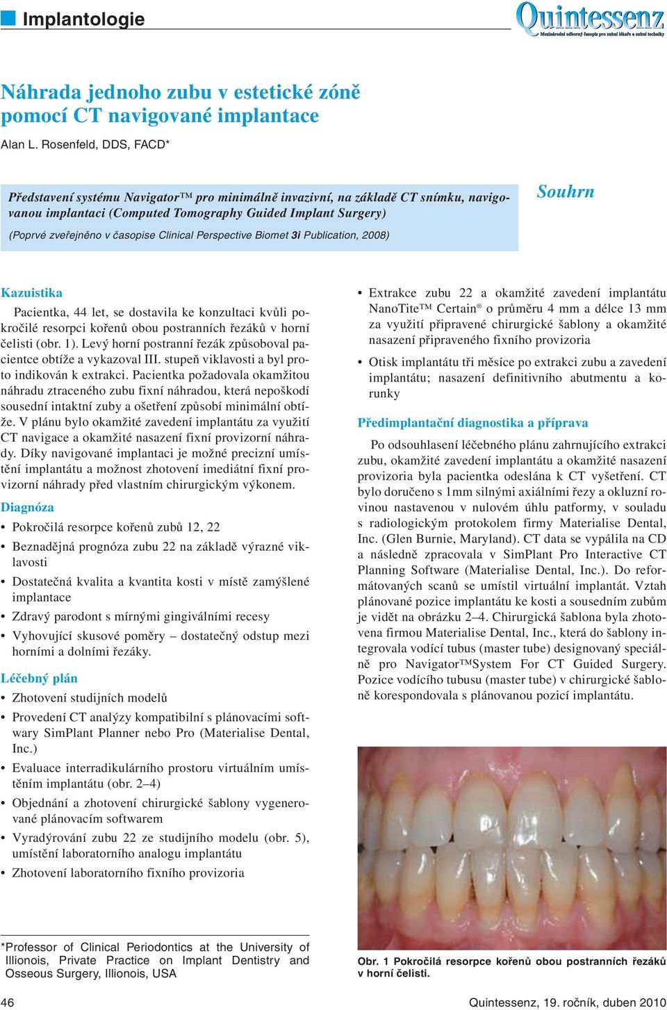 časopise Clinical Perspective Biomet 3i Publication, 2008) Kazuistika Pacientka, 44 let, se dostavila ke konzultaci kvůli pokročilé resorpci kořenů obou postranních řezáků v horní čelisti (obr. 1).