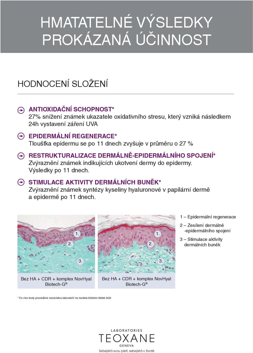 STIMULACE AKTIVITY DERMÁLNÍCH BUNĚK* Zvýraznění známek syntézy kyseliny hyaluronové v papilární dermě a epidermě po 11 dnech. 1 Epidermální regenerace 1. 1. 2.
