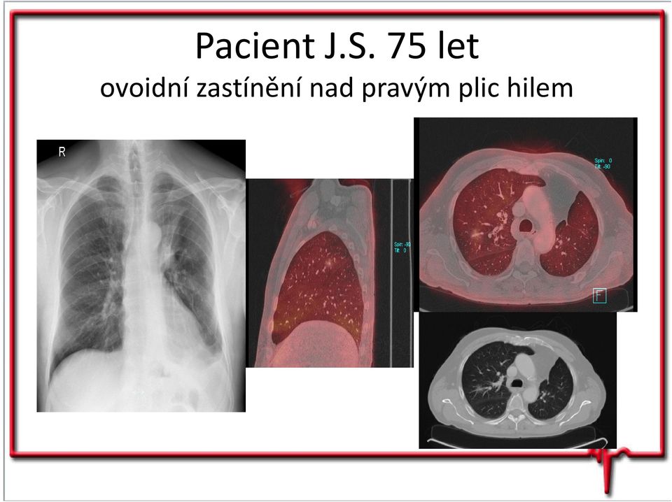 zastínění nad