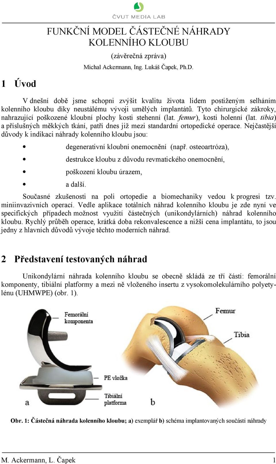 Nejčastější důvody k indikaci náhrady kolenního kloubu jsou: degenerativní kloubní onemocnění (např. osteoartróza), destrukce kloubu z důvodu revmatického onemocnění, poškození kloubu úrazem, a další.