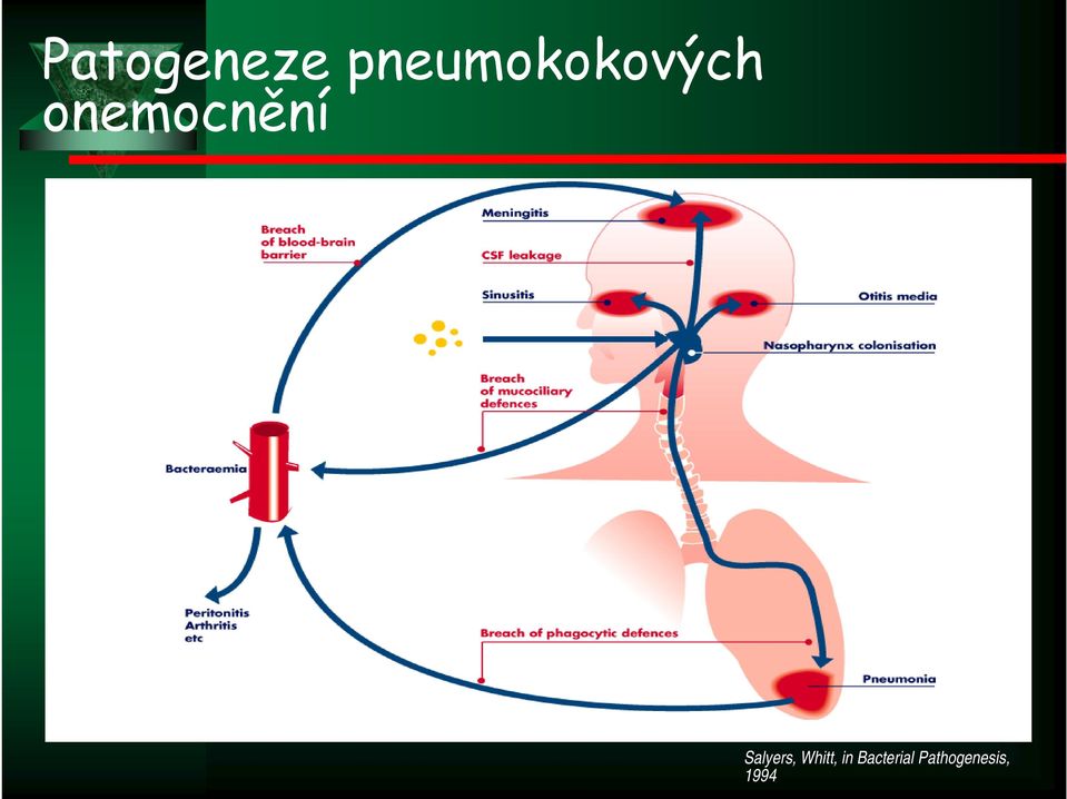 onemocnění Salyers,