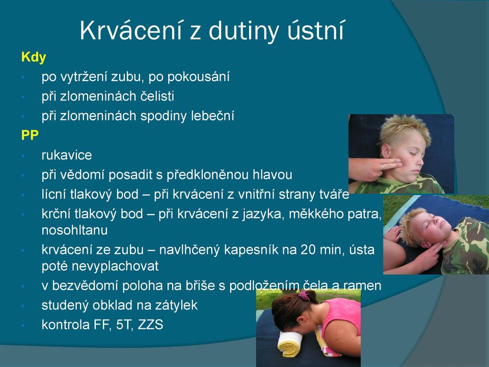 tlakový bod při krvácení z jazyka, měkkého patra, nosohltanu krvácení ze zubu navlhčený kapesník na 20 min, ústa