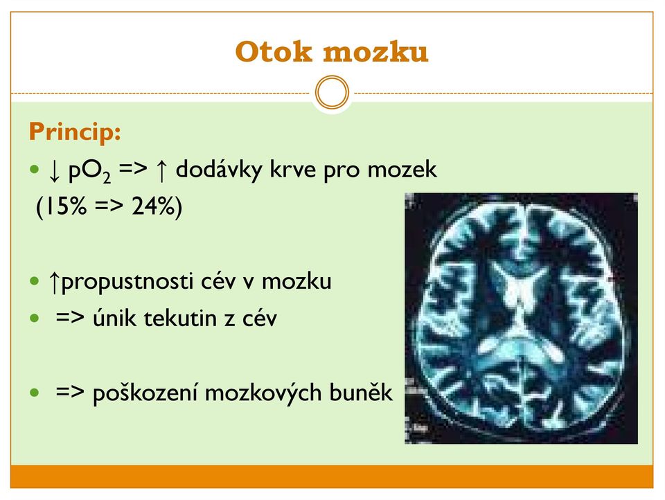 24%) propustnosti cév v mozku =>