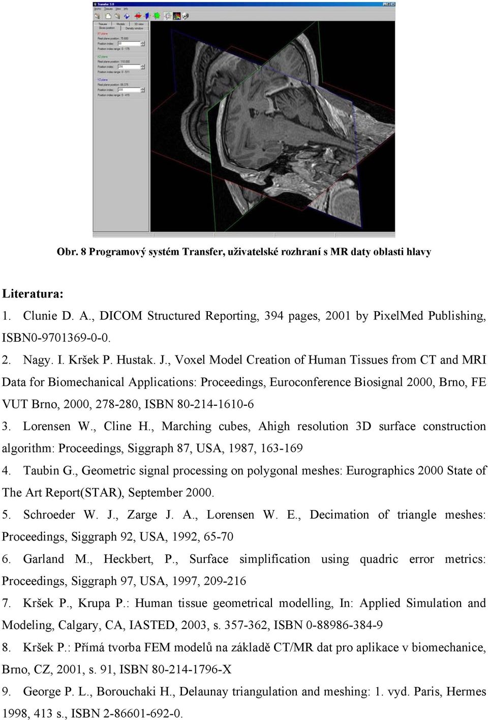 , Voxel Model Creation of Human Tissues from CT and MRI Data for Biomechanical Applications: Proceedings, Euroconference Biosignal 2000, Brno, FE VUT Brno, 2000, 278-280, ISBN 80-214-1610-6 3.