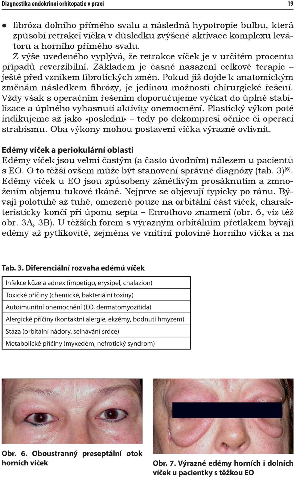 Pokud již dojde k anatomickým změnám následkem fibrózy, je jedinou možností chirurgické řešení.