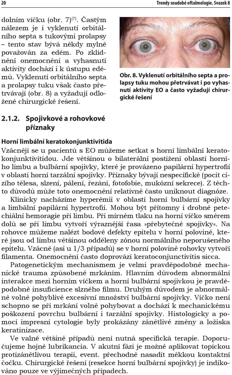 a vyžadují odložené chirurgické řešení. Obr. 8. Vyklenutí orbitálního septa a prolapsy tuku mohou přetrvávat i po vyhasnutí aktivity EO a často vyžadují chirurgické řešení 2.