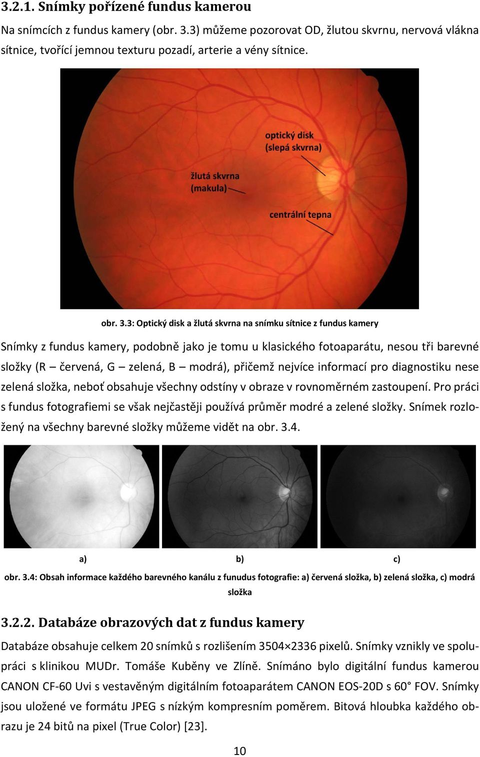 3: Optický disk a žlutá skvrna na snímku sítnice z fundus kamery Snímky z fundus kamery, podobně jako je tomu u klasického fotoaparátu, nesou tři barevné složky (R červená, G zelená, B modrá),