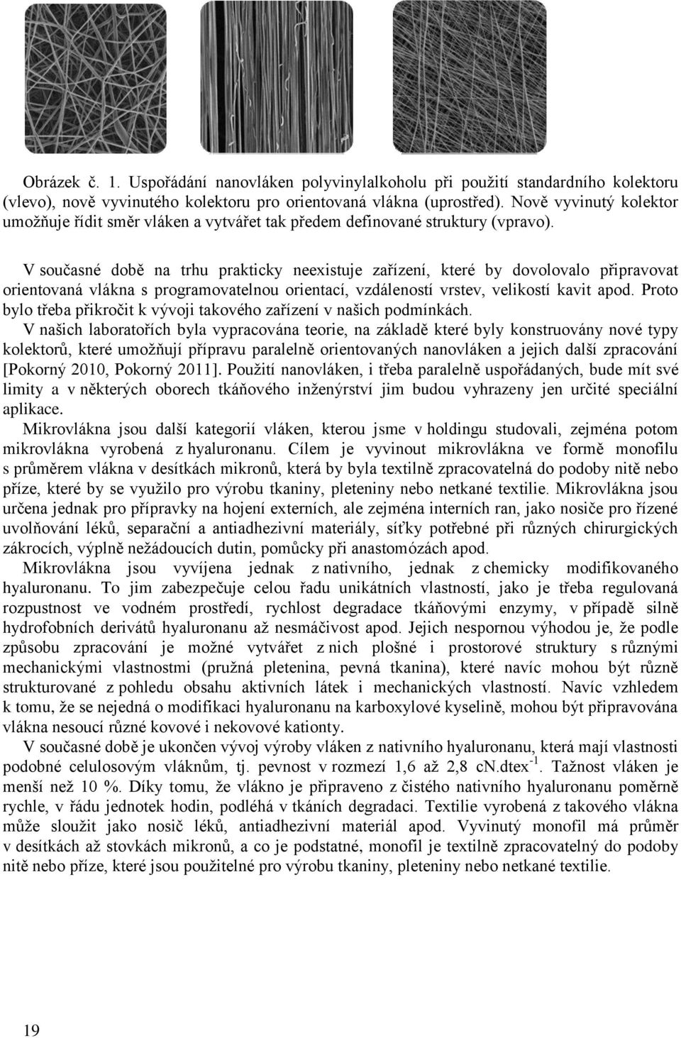 V současné době na trhu prakticky neexistuje zařízení, které by dovolovalo připravovat orientovaná vlákna s programovatelnou orientací, vzdáleností vrstev, velikostí kavit apod.