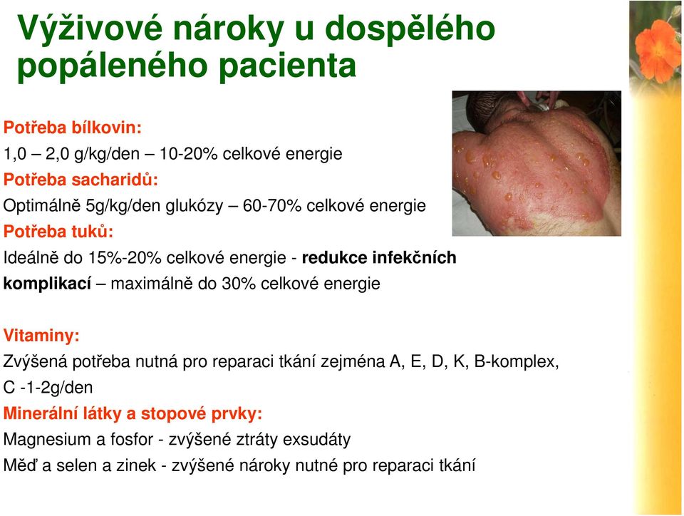 komplikací maximálně do 30% celkové energie Vitaminy: Zvýšená potřeba nutná pro reparaci tkání zejména A, E, D, K, B-komplex, C