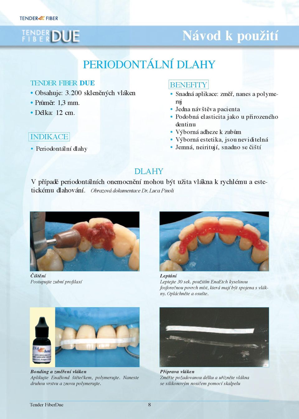 neviditelná Jemná, neiritují, snadno se čiští DLaHY V případě periodontálních onemocnění mohou být užita vlákna k rychlému a estetickému dlahování. Obrazová dokumentace Dr.