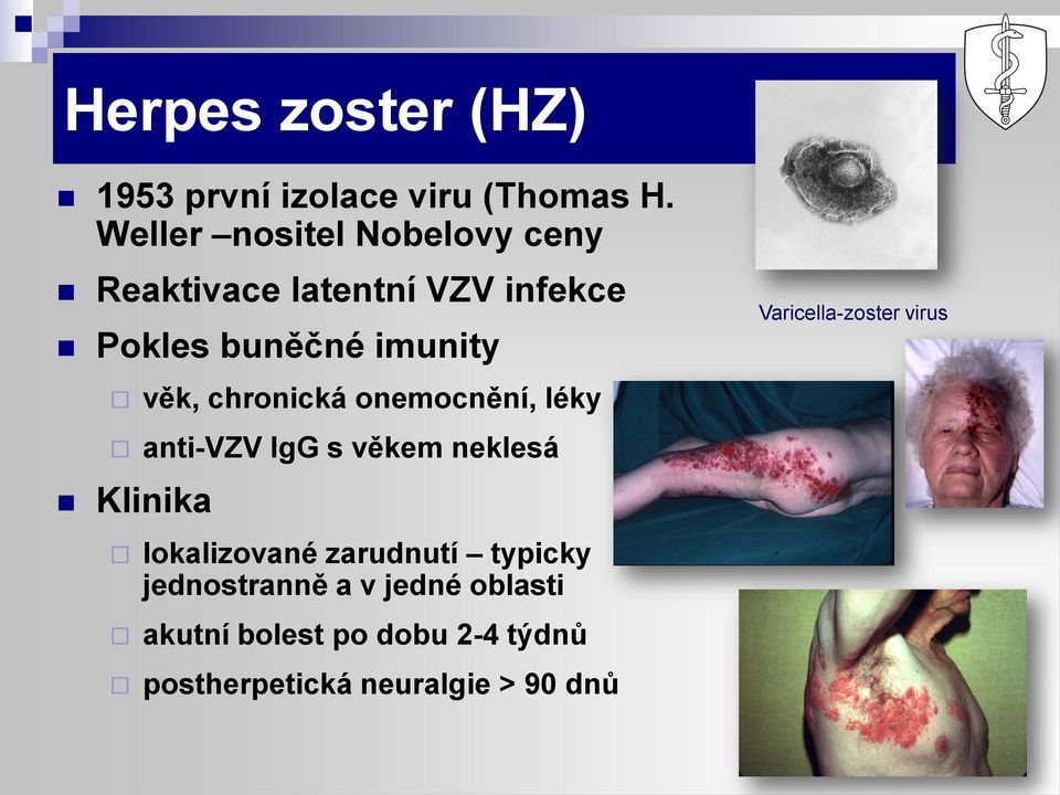 chronická onemocnění, léky anti-vzv IgG s věkem neklesá Klinika lokalizované zarudnutí