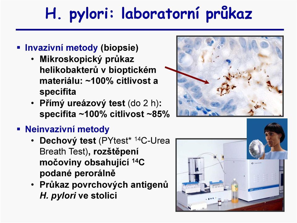 ~100% citlivost ~85% Neinvazivní metody Dechový test (PYtest* 14 C-Urea Breath Test),