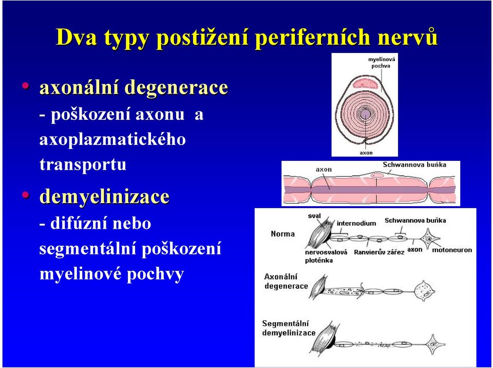 axoplazmatického transportu demyelinizace -