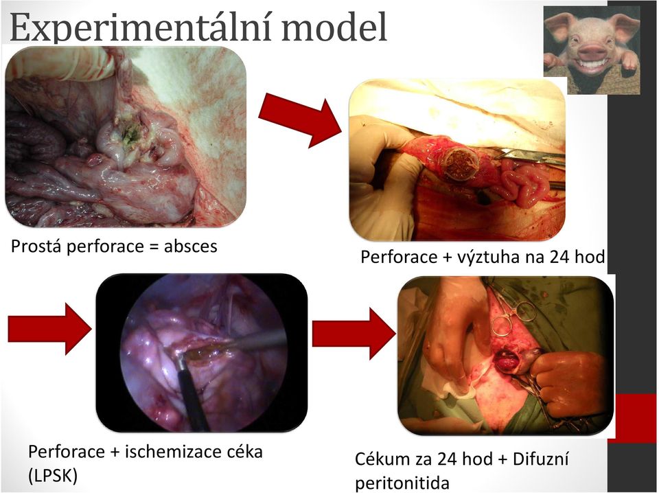 hod Perforace + ischemizace céka