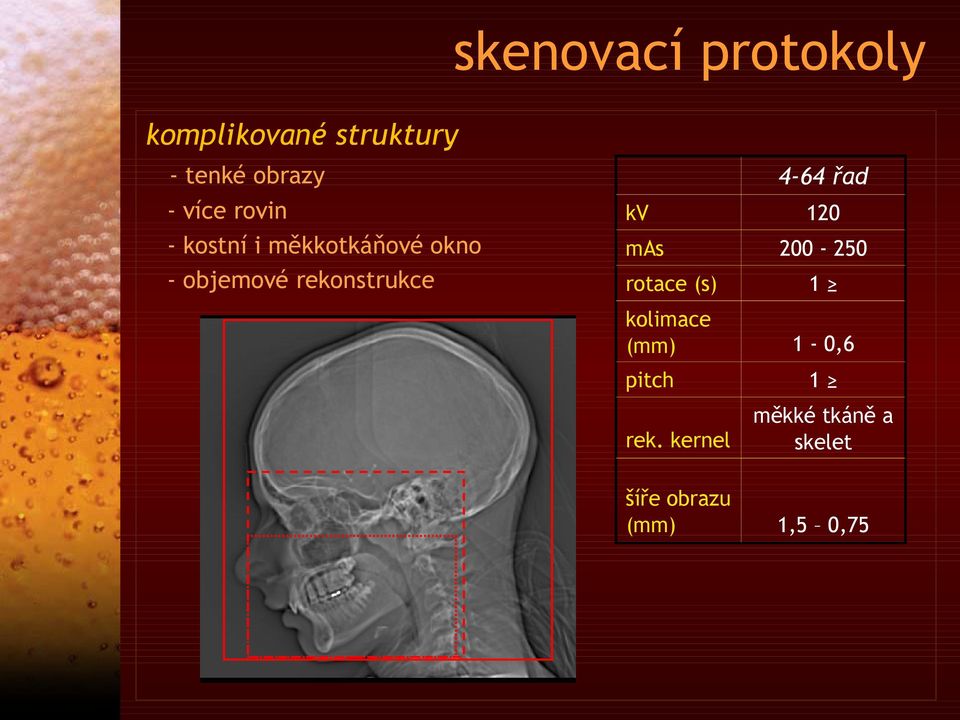 rekonstrukce kv mas 4-64 řad 120 200-250 rotace (s) 1 kolimace