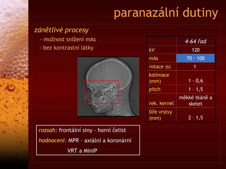 MPR axiální a koronární VRT a MinIP 4-64 řad 120 70-100 rotace (s) 1