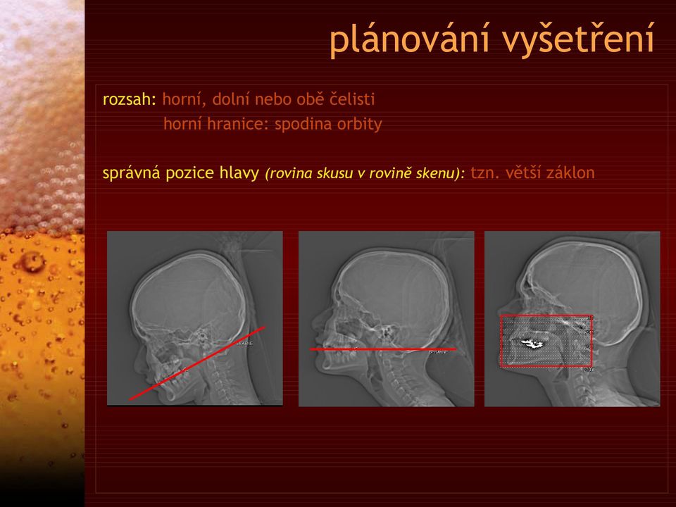 spodina orbity správná pozice hlavy