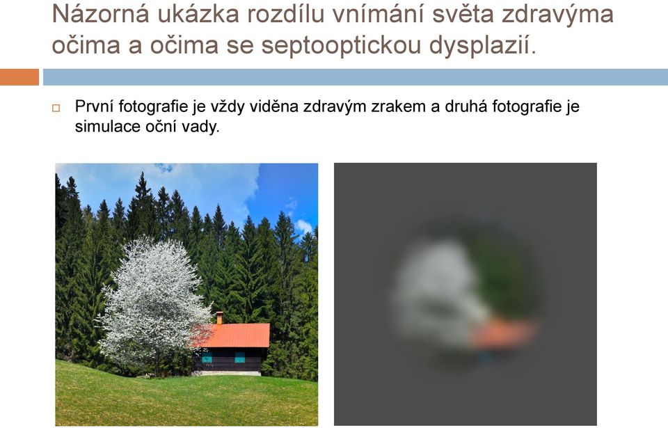 dysplazií.