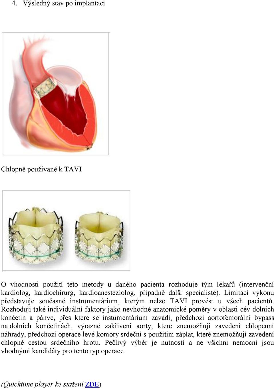 Rozhoduji také individuální faktory jako nevhodné anatomické poměry v oblasti cév dolních končetin a pánve, přes které se instumentárium zavádí, předchozí aortofemorální bypass na dolních