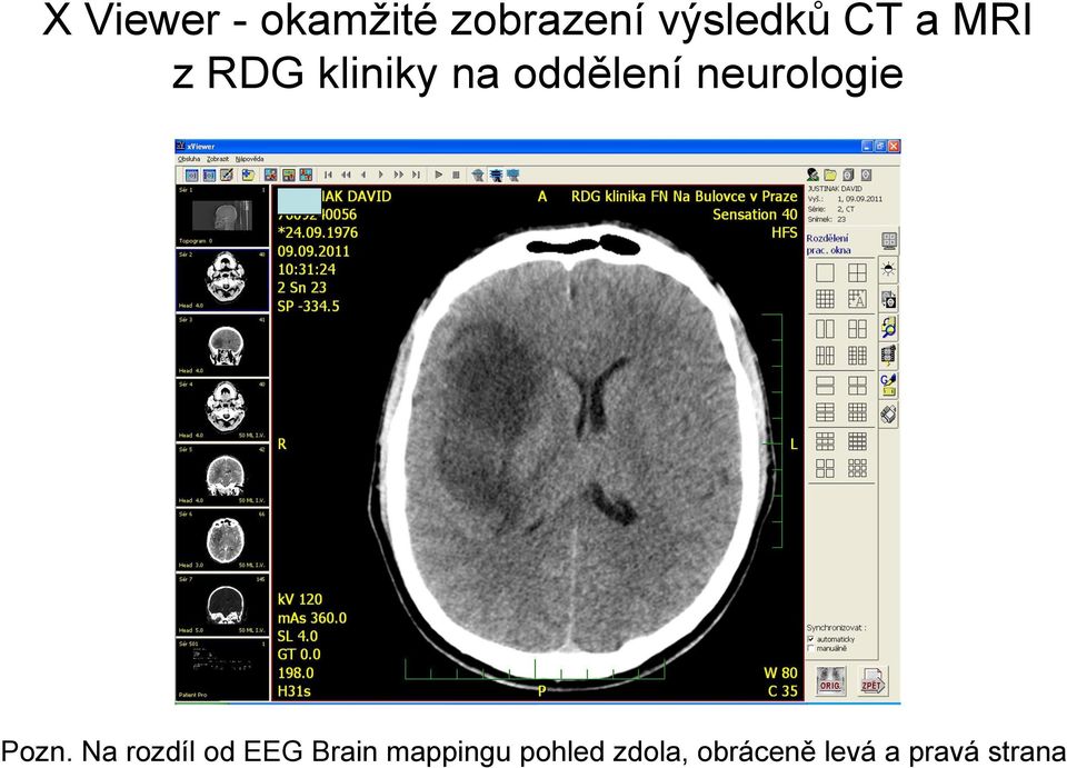 neurologie Pozn.