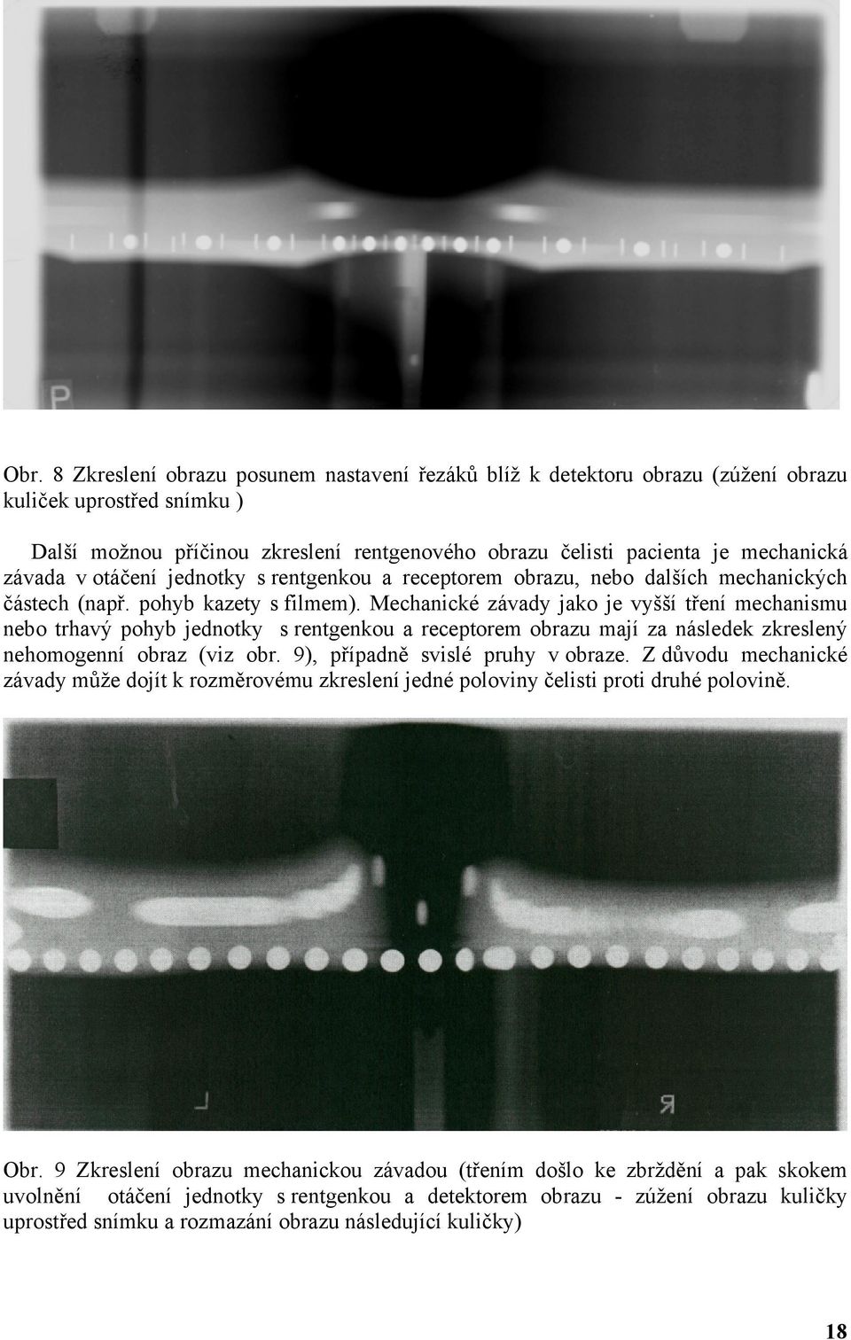 Mechanické závady jako je vyšší tření mechanismu nebo trhavý pohyb jednotky s rentgenkou a receptorem obrazu mají za následek zkreslený nehomogenní obraz (viz obr. 9), případně svislé pruhy v obraze.
