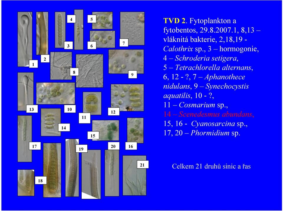 , 3 hormogonie, 4 Schroderia setigera, 5 Tetrachlorella alternans, 6, 12 -?