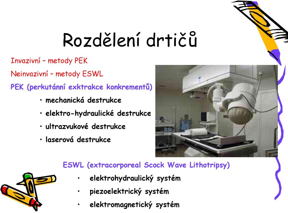 ultrazvukové destrukce laserová destrukce ESWL (extracorporeal Scock Wave