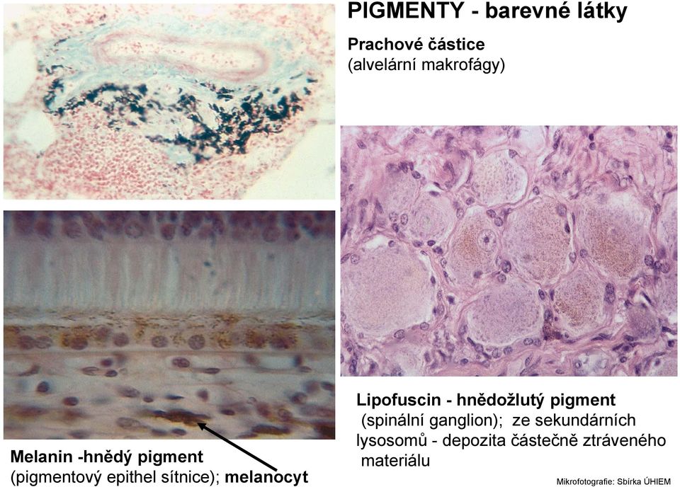 Lipofuscin - hnědožlutý pigment (spinální ganglion); ze sekundárních