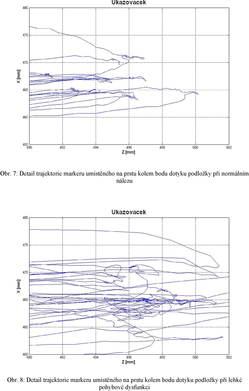 Obr. 8: Detail trajektorie markeru umístěného na