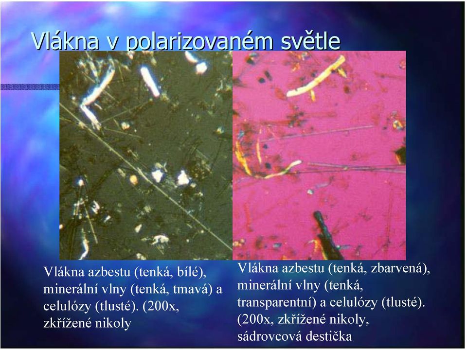 (200x, zkřížené nikoly Vlákna azbestu (tenká, zbarvená), minerální