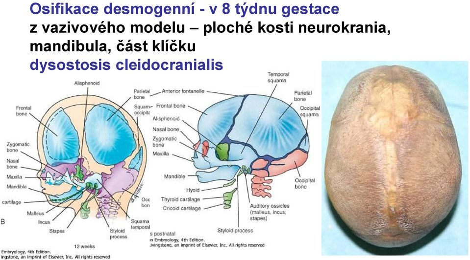 ploché kosti neurokrania,
