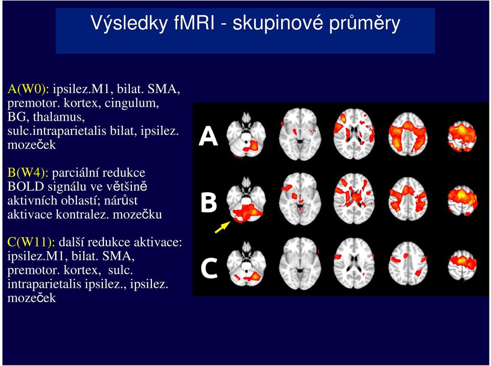 mozeček B(W4): parciální redukce BOLD signálu ve většině aktivních oblastí; nárůst aktivace