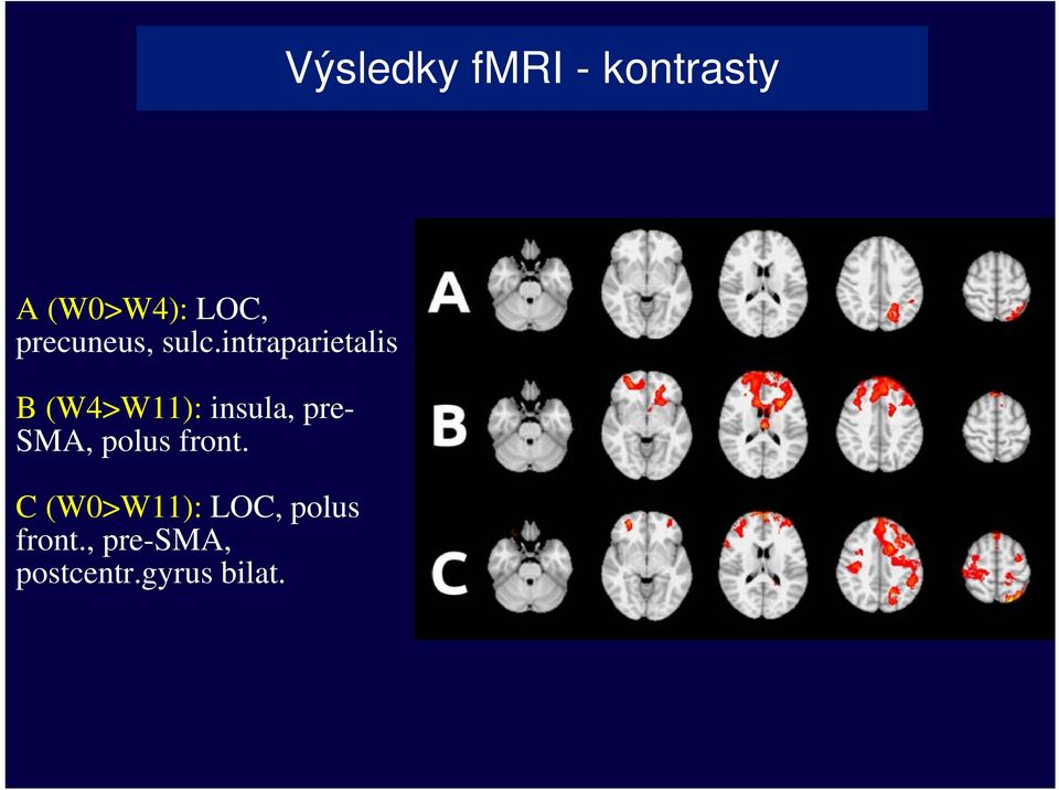 intraparietalis B (W4>W11): insula, pre-