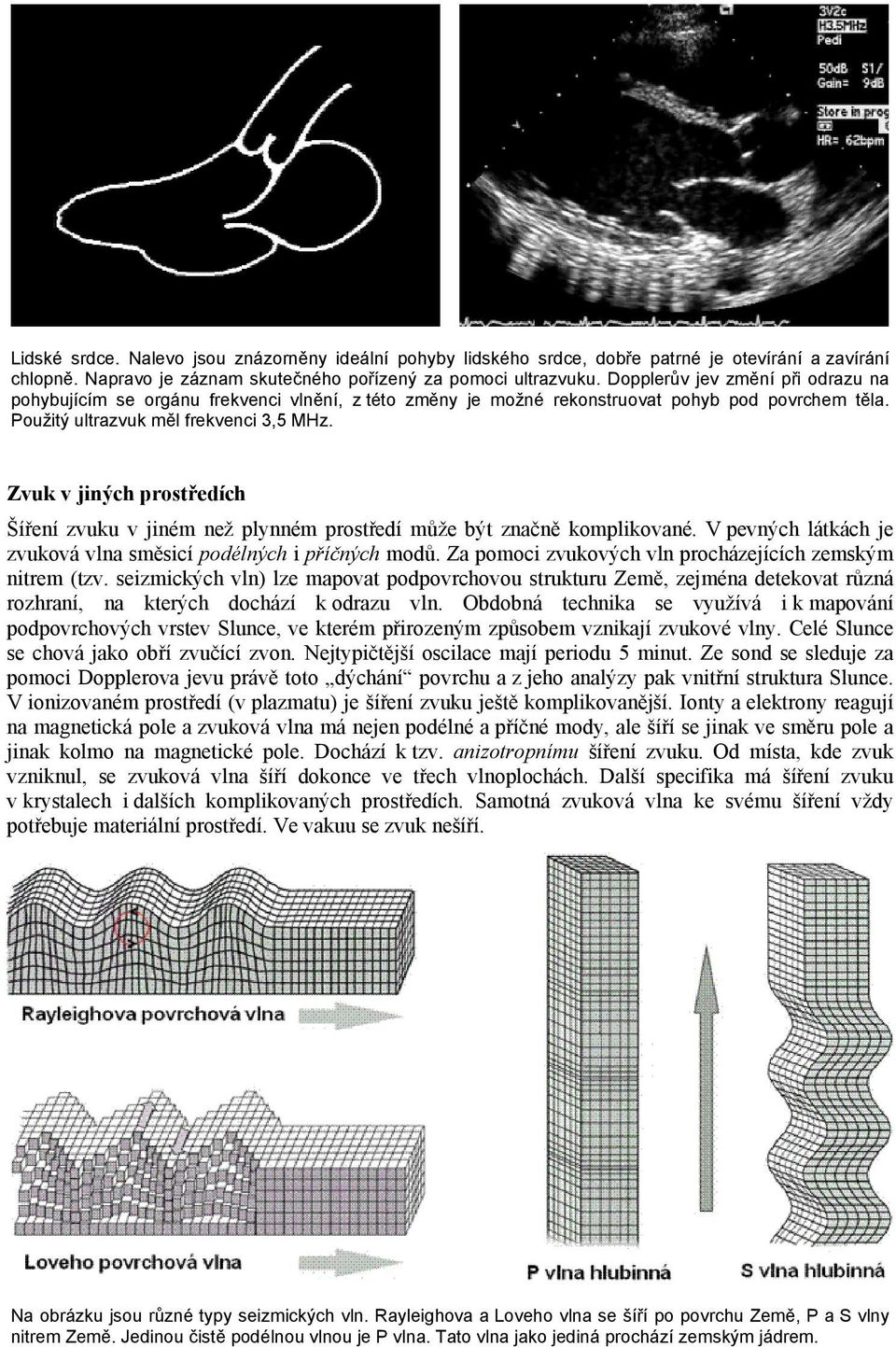 Zvuk v jiných prostředích Šíření zvuku v jiném než plynném prostředí může být značně komplikované. V pevných látkách je zvuková vlna směsicí podélných i příčných modů.