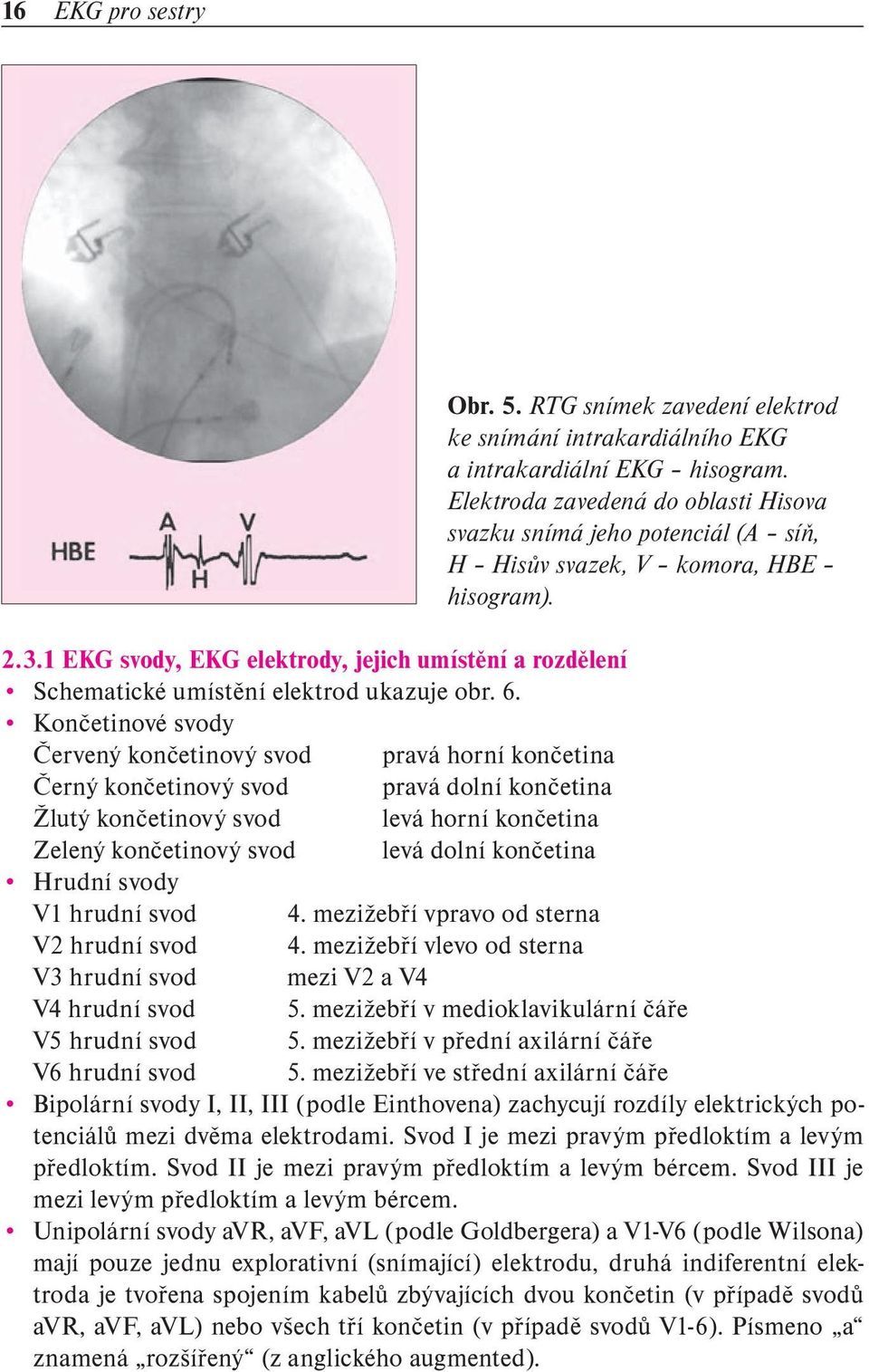 1 EKG svody, EKG elektrody, jejich umístění a rozdělení Schematické umístění elektrod ukazuje obr. 6.