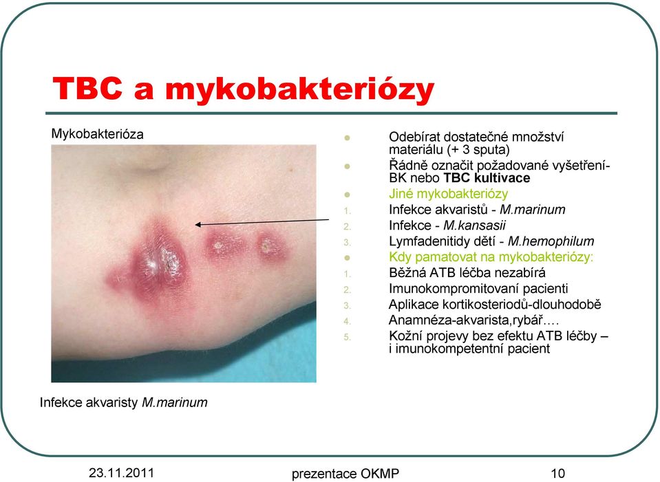 hemophilum Kdy pamatovat na mykobakteriózy: 1. Běžná ATB léčba nezabírá 2. Imunokompromitovaní pacienti 3.