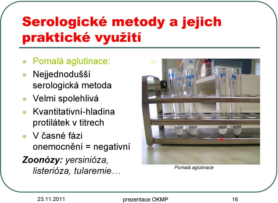protilátek v titrech V časné fázi onemocnění = negativní Zoonózy: