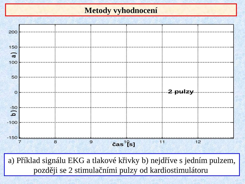 signálu EKG a tlakové křivky b) nejdříve s jedním