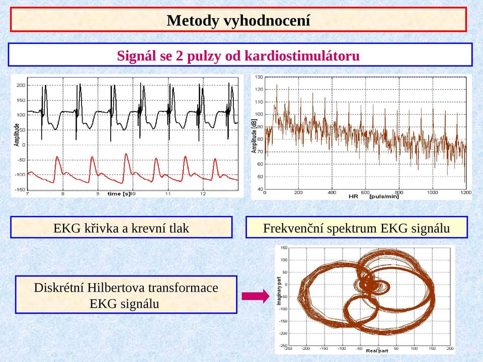 tlak Diskrétní Hilbertova transformace