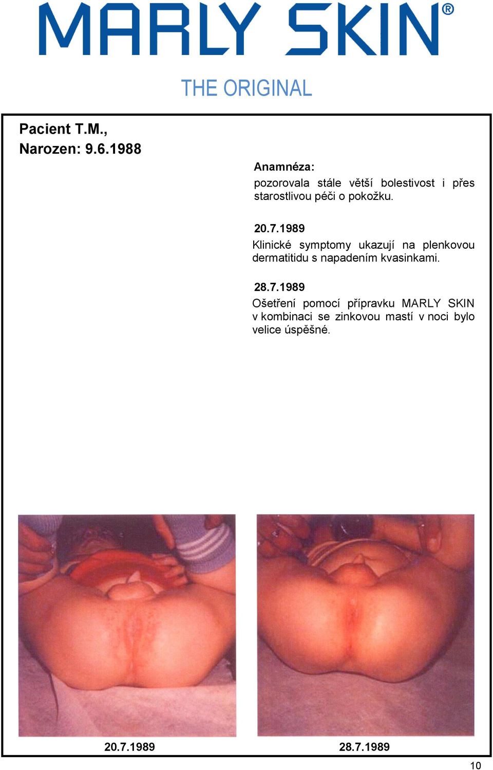 7.1989 Klinické symptomy ukazují na plenkovou dermatitidu s napadením