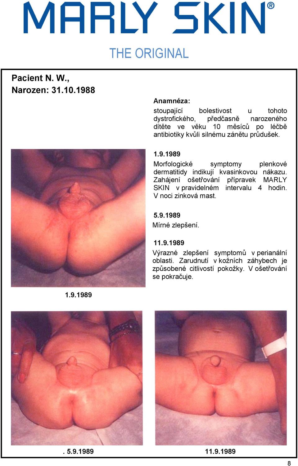 průdušek. 1.9.1989 Morfologické symptomy plenkové dermatitidy indikují kvasinkovou nákazu.