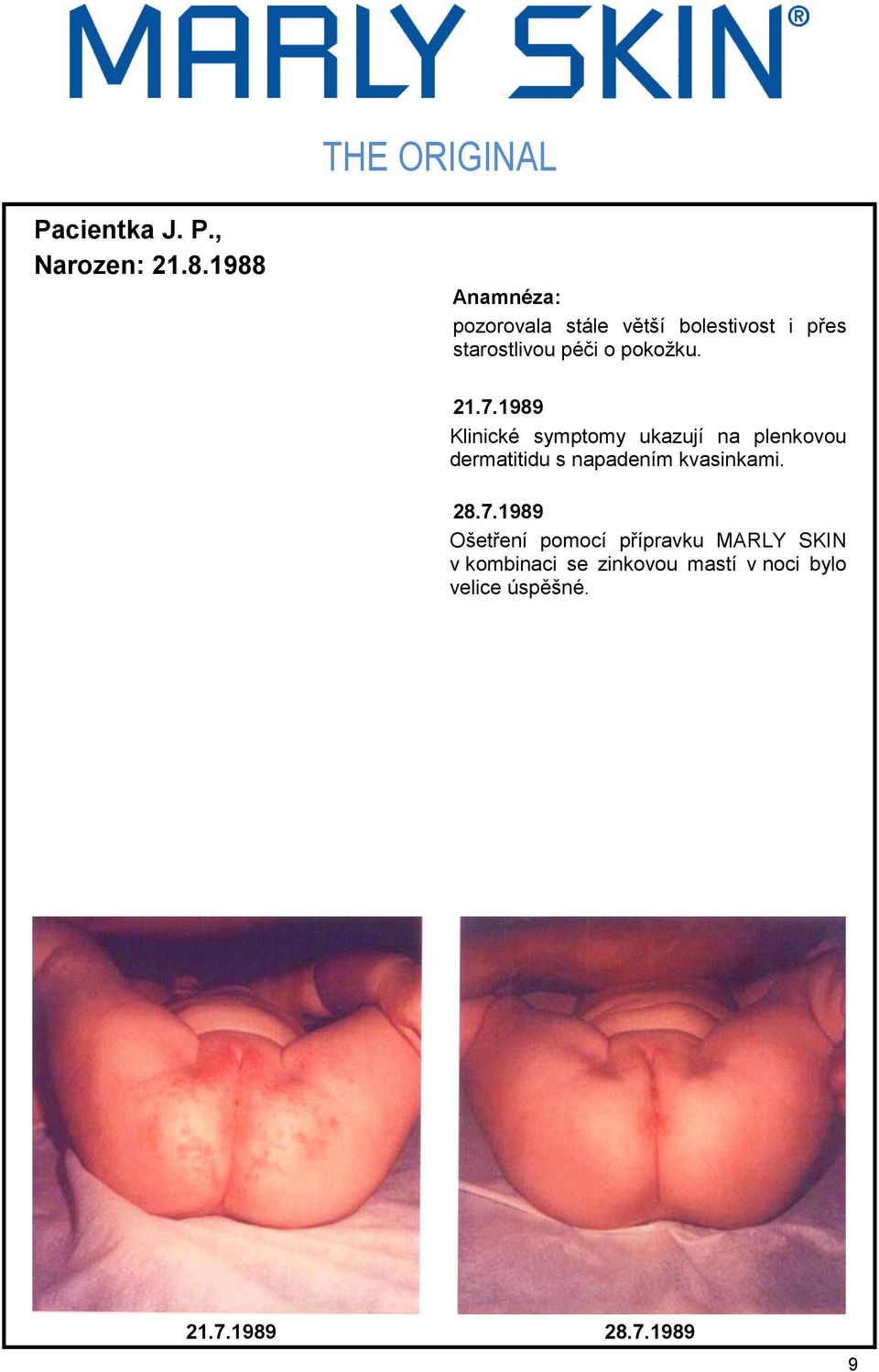 7.1989 Klinické symptomy ukazují na plenkovou dermatitidu s napadením