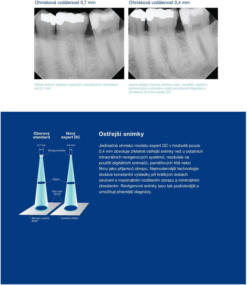 4 mm Röntgenstrahler Objekt Film oder Sensor Jedinečné ohnisko modelu expert DC v hodnotě pouze 0,4 mm dovoluje zřetelně ostřejší snímky než u ostatních intraorálních rentgenových systémů, nezávisle